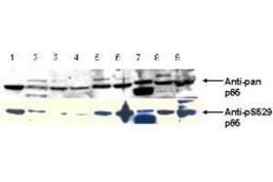 Image no. 2 for anti-Nuclear Factor-kB p65 (NFkBP65) (pSer276) antibody (ABIN1103942) (NF-kB p65 Antikörper  (pSer276))