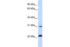 WB Suggested Anti-AP3S1 Antibody Titration: 0. (AP3S1 Antikörper  (N-Term))