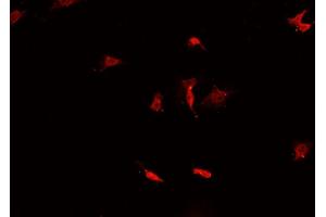 Immunofluorescence (fixed cells) (IF/ICC) image for anti-Caspase 3 (CASP3) (Internal Region) antibody (ABIN6260481)