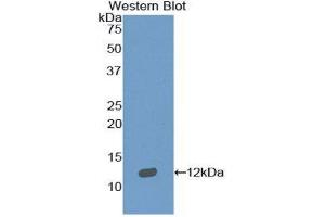 Western Blotting (WB) image for anti-Sema Domain, Immunoglobulin Domain (Ig), Short Basic Domain, Secreted, (Semaphorin) 3E (SEMA3E) (AA 651-740) antibody (ABIN1860520) (SEMA3E Antikörper  (AA 651-740))