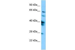 Western Blotting (WB) image for anti-Sperm Associated Antigen 16 (SPAG16) (N-Term) antibody (ABIN2790381) (SPAG16 Antikörper  (N-Term))
