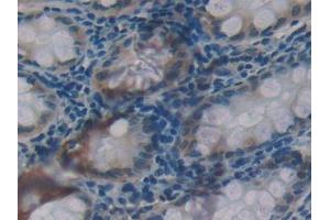 Used in DAB staining on fromalin fixed paraffin- embedded kidney tissue (Glucocorticoid Receptor Antikörper  (AA 41-184))