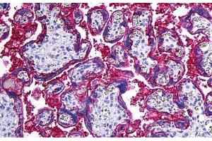 Human Placenta: Formalin-Fixed, Paraffin-Embedded (FFPE) (CD46 Antikörper)