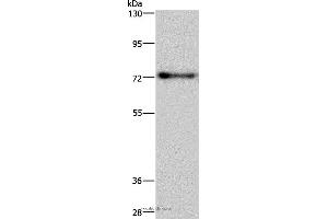 Western blot analysis of Mouse brain tissue, using PATZ1 Polyclonal Antibody at dilution of 1:250 (PATZ1 Antikörper)