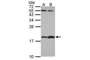 Image no. 1 for anti-Fatty Acid Binding Protein 7, Brain (FABP7) (AA 1-132) antibody (ABIN1498175)