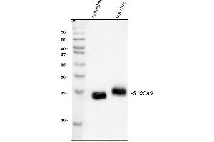 Western blot analysis of S100A9 using anti-S100A9 antibody (ABIN3042482). (S100A9 Antikörper  (AA 2-113))