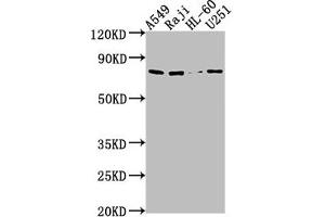 Western Blot Positive WB detected in: A549 whole cell lysate, Raji whole cell lysate, HL60 whole cell lysate, U251 whole cell lysate All lanes: RANBP9 antibody at 1:1000 Secondary Goat polyclonal to rabbit IgG at 1/50000 dilution Predicted band size: 78, 44, 56 kDa Observed band size: 78 kDa (Importin 9 Antikörper  (AA 158-176))