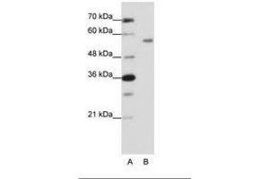 Image no. 1 for anti-Zinc Finger Protein 497 (ZNF497) (N-Term) antibody (ABIN202666) (ZNF497 Antikörper  (N-Term))
