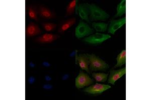 ABIN6257139 and ABIN6275758 staining  cells by IF/ICC. (DUSP10 Antikörper  (Internal Region))