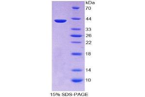 SDS-PAGE (SDS) image for Keratin 3 (KRT3) (AA 198-514) protein (His tag) (ABIN2125560)