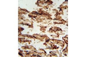IGFBP4 antibody (Center) (ABIN652262 and ABIN2841131) immunohistochemistry analysis in formalin fixed and paraffin embedded human placenta tissue followed by peroxidase conjugation of the secondary antibody and DAB staining. (IGFBP4 Antikörper  (AA 96-124))