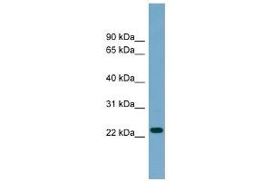 ARL8B antibody used at 1 ug/ml to detect target protein.