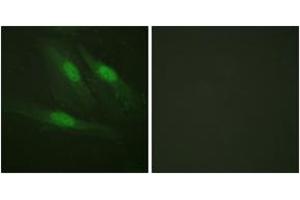 Immunofluorescence (IF) image for anti-Catenin, beta (CATNB) (AA 620-669) antibody (ABIN1532553)