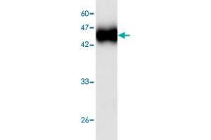 Western blot analysis in cgd7_4540 recombinant protein with cgd7_4540 monoclonal antibody, clone 55d68  at 1 : 1000 dilution.