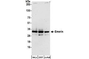 Western Blotting (WB) image for anti-Emerin (EMD) (AA 1-50) antibody (ABIN7450209)