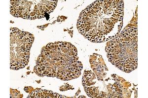 ABIN7096010 and ABIN7100072 at 1/100 staining mouse testis tissue by IHC-P.