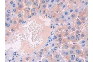 Immunohistochemistry (IHC) image for anti-Interleukin 1 Receptor, Type I (IL1R1) (AA 119-217) antibody (ABIN7430741)