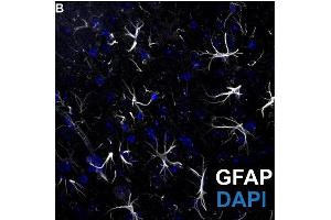 Representative image of GFP positive (white, cat.