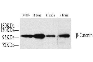 Western Blot analysis of various samples using Catenin beta Polyclonal Antibody at dilution of 1:1000. (beta Catenin Antikörper)