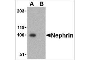 Western blot analysis in mouse kidney tissue lysate using Nephrin Antibody at 1 μg/ml in the (A) absence and (B) presence of blocking peptide. (Nephrin Antikörper  (C-Term))