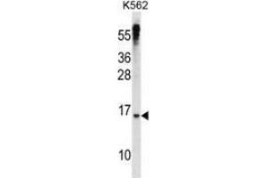 Western blot analysis in K562 cell line lysates (35ug/lane) using MAD3 Antibody (N-term). (MXD3 Antikörper  (N-Term))