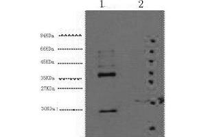 Western Blot analysis of 1) Hela, 2) 293T cells using CA9 Monoclonal Antibody at dilution of 1:5000. (CA9 Antikörper)