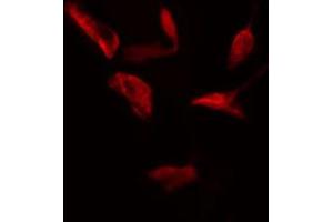 ABIN6274756 staining HeLa cells by IF/ICC. (RPS4X Antikörper  (Internal Region))