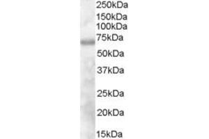 ABIN185227 (1µg/ml) staining of Human Thymus lysate (35µg protein in RIPA buffer). (DEF6 Antikörper  (N-Term))