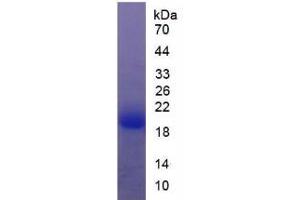 SDS-PAGE analysis of Rat Thyroid Peroxidase Protein.
