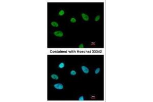 ICC/IF Image Immunofluorescence analysis of paraformaldehyde-fixed A549, using SOX2, antibody at 1:200 dilution. (SOX2 Antikörper)