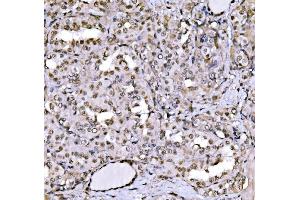 IHC analysis of CBX1/HP1 beta using anti-CBX1/HP1 beta antibody (ABIN7602012). (CBX1 Antikörper  (AA 55-185))