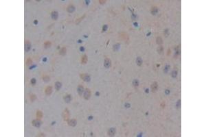 Used in DAB staining on fromalin fixed paraffin-embedded kidney tissue (CELSR3 Antikörper  (AA 942-1175))