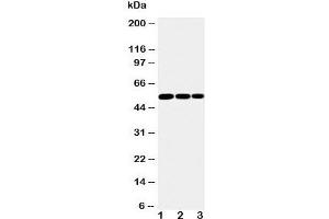 Western blot testing of IKK gamma antibody and Lane 1:  mouse liver;  2: mouse brain;  3: mouse ovary tissue lysate. (IKBKG Antikörper  (N-Term))