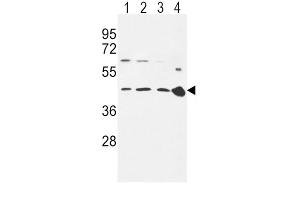 Western Blotting (WB) image for anti-Chemokine (C-C Motif) Receptor 7 (CCR7) antibody (ABIN5021834)