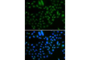 Immunofluorescence analysis of A549 cells using ALKBH8 antibody. (ALKBH8 Antikörper  (AA 1-230))