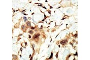 Immunohistochemistry (IHC) image for anti-Insulin Receptor (INSR) (AA 21-52) antibody (ABIN3031335)