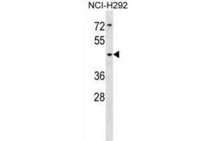 Western Blotting (WB) image for anti-Sialic Acid Binding Ig-Like Lectin 14 (SIGLEC14) antibody (ABIN5018304) (SIGLEC14 Antikörper)