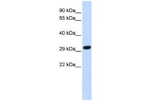 SDCBP antibody used at 1 ug/ml to detect target protein. (SDCBP Antikörper)