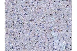 IHC analysis of SEMA4F using anti-SEMA4F antibody (ABIN7601432).