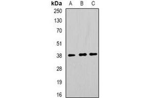 Western blot analysis of TorsinA expression in MCF7 (A), SW480 (B), mouse liver (C) whole cell lysates. (TOR1A Antikörper)