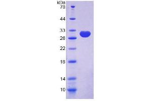 SDS-PAGE analysis of Human C/EBP delta Protein. (CEBPD Protein)