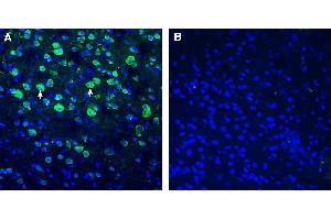 Expression of BMPR1A in mouse cortex.