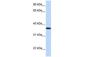 WB Suggested Anti-LCN12 Antibody Titration: 0.