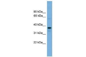 VPS16 antibody used at 0. (VPS16 Antikörper  (N-Term))