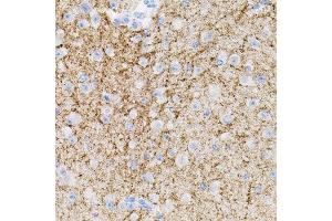 Immunohistochemistry of paraffin-embedded mouse brain using NTF3 antibody. (Neurotrophin 3 Antikörper  (AA 19-257))