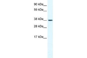 TRPM3 antibody used at 1.