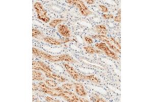 Immunohistochemistry (Paraffin-embedded Sections) (IHC (p)) image for anti-Folate Receptor 1 (Adult) (FOLR1) (AA 33-68), (N-Term) antibody (ABIN654650)