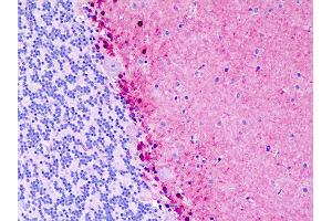 Immunohistochemistry (IHC) image for anti-S100 Calcium Binding Protein B (S100B) (AA 28-56) antibody (ABIN1804587)