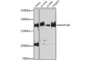 Western blot analysis of extracts of various cell lines, using NUP160 Rabbit pAb (ABIN6133841, ABIN6144957 and ABIN7101841) at 1:3000 dilution. (NUP160 Antikörper)