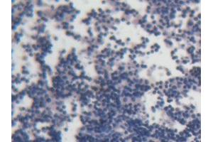 DAB staining on IHC-P; Samples: Rat Lymph node Tissue
